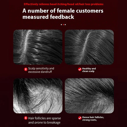 3 Modes Electric Massage Comb Portable Red Light Laser Comb for Hair Follicle Hair Follicles